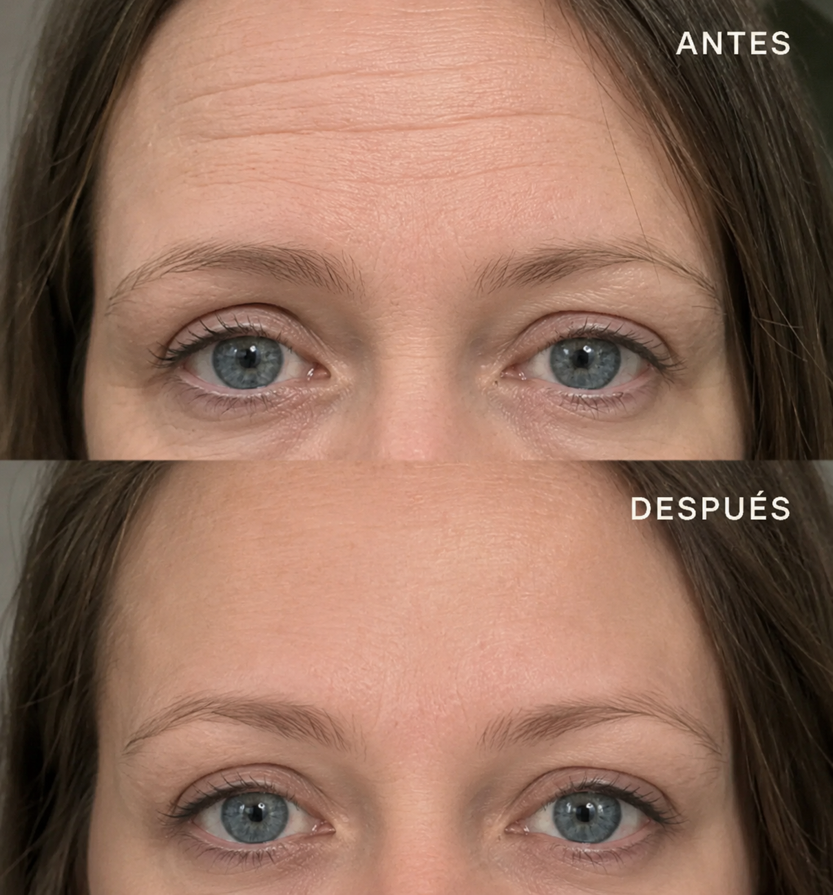 Noreluxa Overnight Lift Patches™